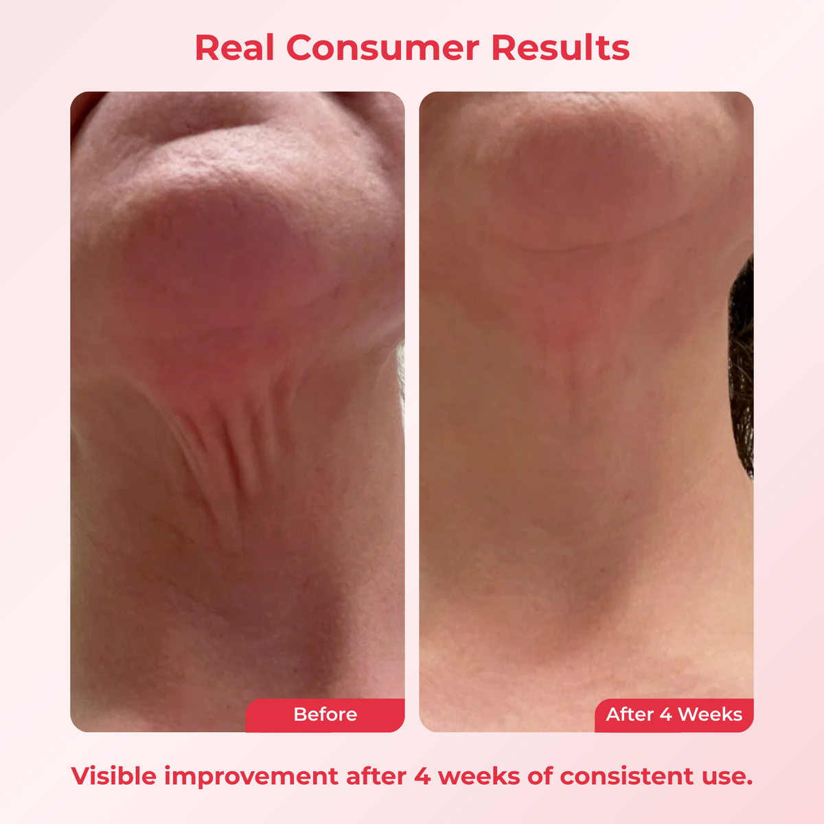 Koridem™ Time Reverse Neck Cream